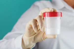 Mão enluvada de profissional de saúde segurando recipiente com amostra de sêmen para exame de espermograma.