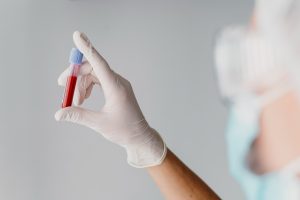 Mão com luva segurando uma amostra de sangue para o exame de dosagem hormonal.