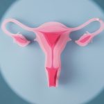 Ilustração do sistema reprodutor feminino com as tubas uterinas, útero e ovário.
