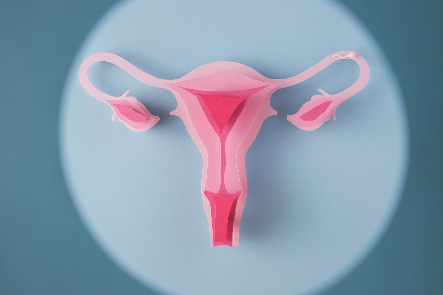 Ilustração do sistema reprodutor feminino com as tubas uterinas, útero e ovário.