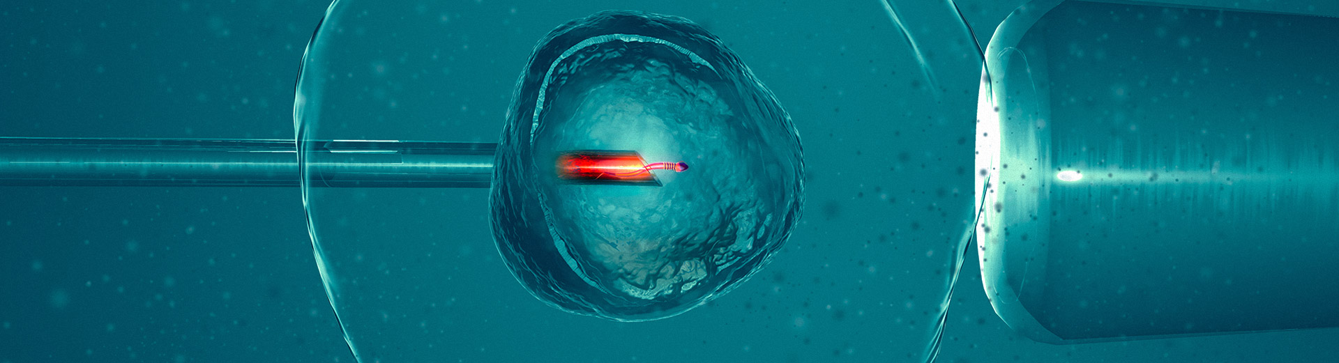 Fertilização In vitro na Huntington