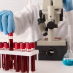 Tubos de coleta com sangue para a realização de exames hormonais femininos
