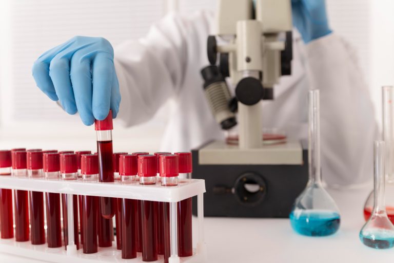 Tubos de coleta com sangue para a realização de exames hormonais femininos