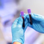 Mãos segurando tubos de coleta de sangue para o exame FSH
