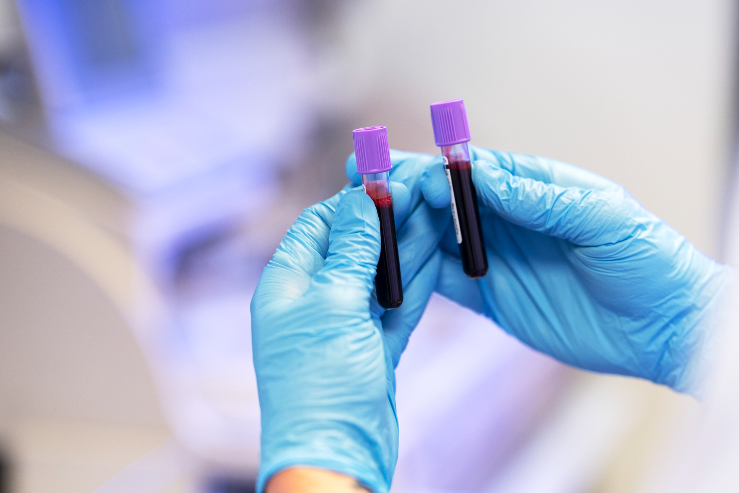 Mãos segurando tubos de coleta de sangue para o exame FSH